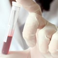 What would show up in a hormone blood test?