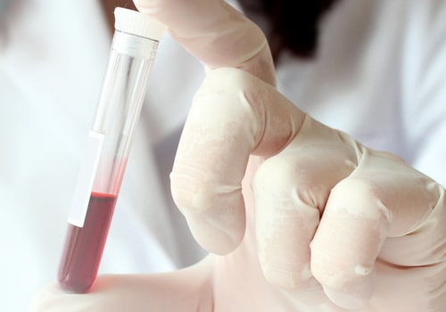 What would show up in a hormone blood test?